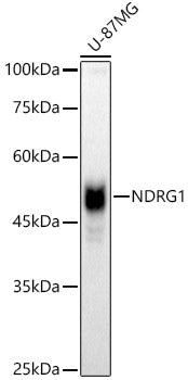 [KO Validated] NDRG1 Rabbit pAb