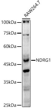 [KO Validated] NDRG1 Rabbit pAb