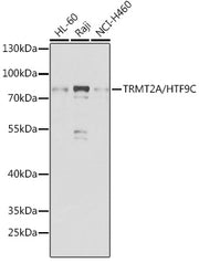 TRMT2A/HTF9C Rabbit pAb