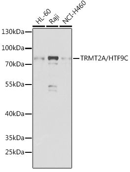 TRMT2A/HTF9C Rabbit pAb