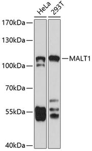 MALT1 Rabbit pAb