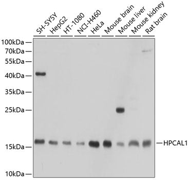 HPCAL1 Rabbit pAb