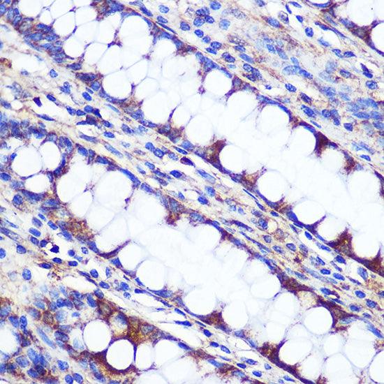 LETMD1 Rabbit pAb