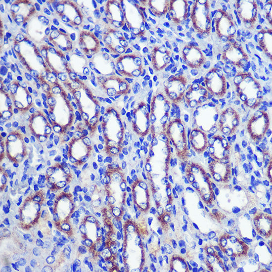 LETMD1 Rabbit pAb