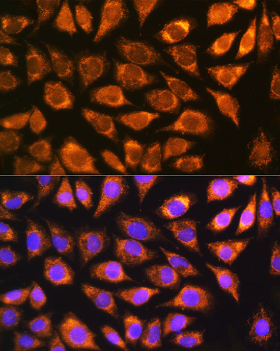 [KD Validated] NDUFS5 Rabbit pAb