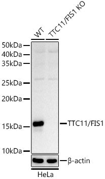 [KO Validated]  TTC11/FIS1 Rabbit pAb