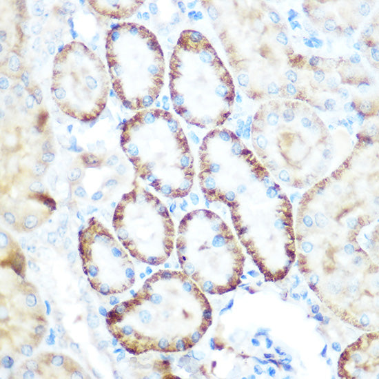 [KO Validated] PEPCK/PCK2 Rabbit pAb