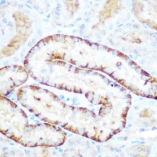 [KO Validated] PEPCK/PCK2 Rabbit pAb