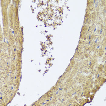 PIK3C2A Rabbit pAb