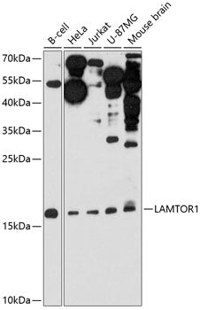LAMTOR1 Rabbit pAb