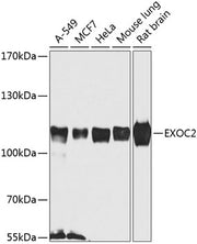 EXOC2 Rabbit pAb