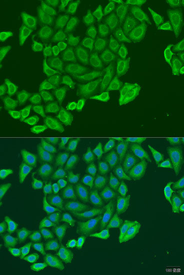 EXOC2 Rabbit pAb