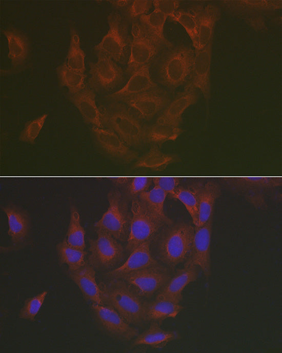 Caspase-3 Rabbit pAb