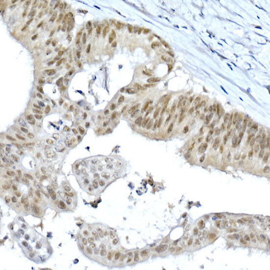 METTL3 Rabbit pAb