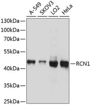 RCN1 Rabbit pAb