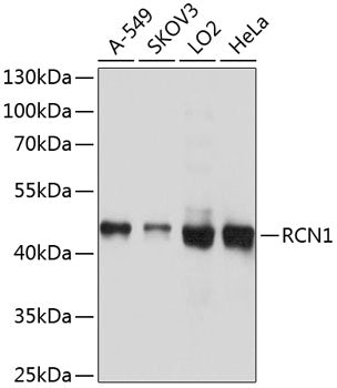 RCN1 Rabbit pAb