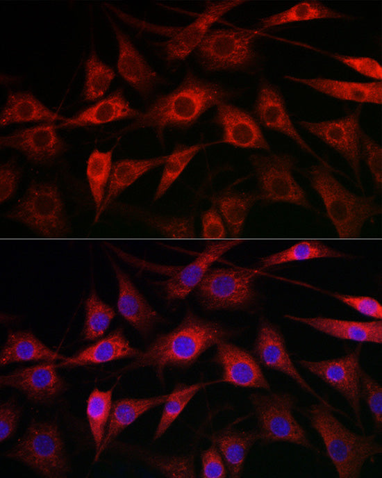 CYP1A1 Rabbit pAb