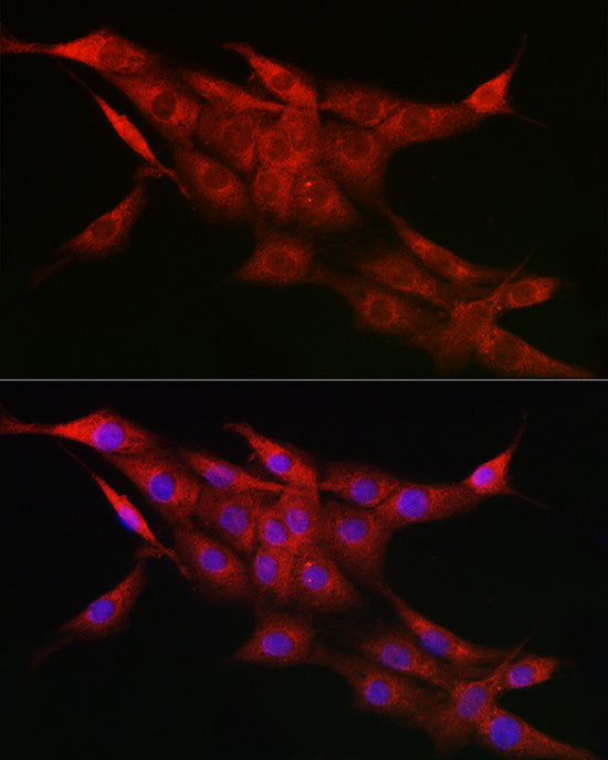 CYP1A1 Rabbit pAb
