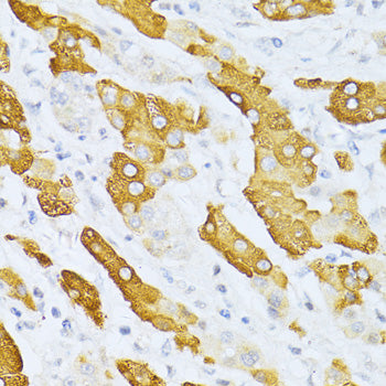 CYP2E1 Rabbit pAb