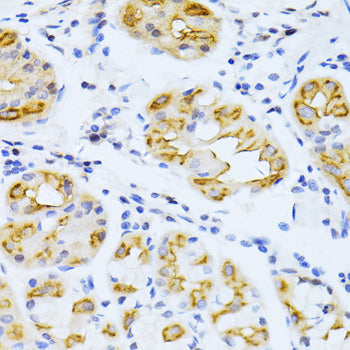 CYP2E1 Rabbit pAb