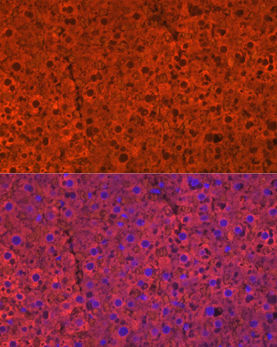 CYP2E1 Rabbit pAb