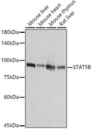[KO Validated] STAT5B Rabbit pAb