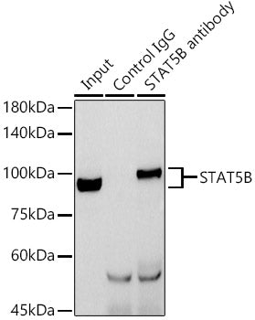 [KO Validated] STAT5B Rabbit pAb