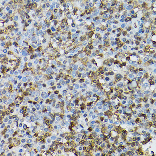 [KO Validated] STAT5B Rabbit pAb