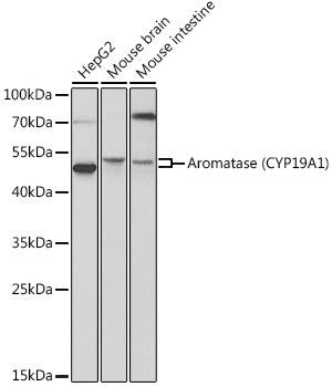 Aromatase (CYP19A1) Rabbit pAb