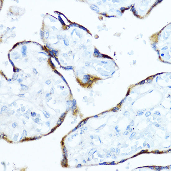 Aromatase (CYP19A1) Rabbit pAb