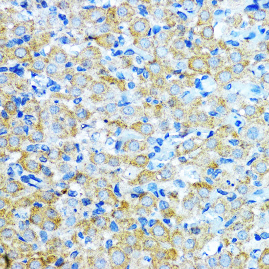 Aromatase (CYP19A1) Rabbit pAb