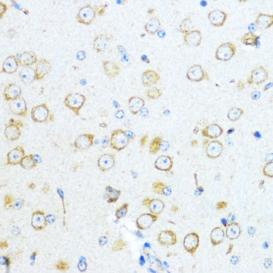 Aromatase (CYP19A1) Rabbit pAb