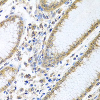 [KD Validated] eIF4E Rabbit pAb