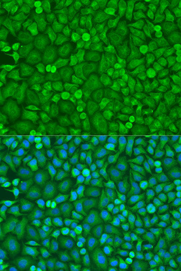 [KD Validated] eIF4E Rabbit pAb