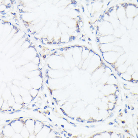 p53 Rabbit pAb