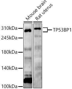 TP53BP1 Rabbit pAb