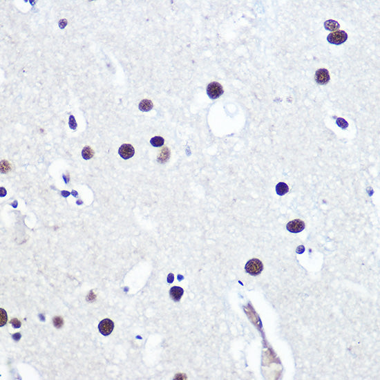 TP53BP1 Rabbit pAb