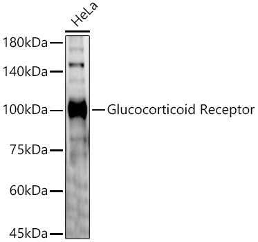 Glucocorticoid Receptor Rabbit pAb