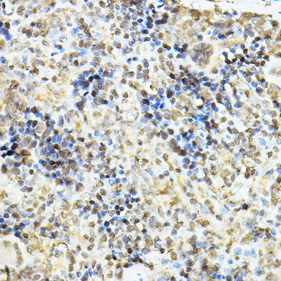Glucocorticoid Receptor Rabbit pAb