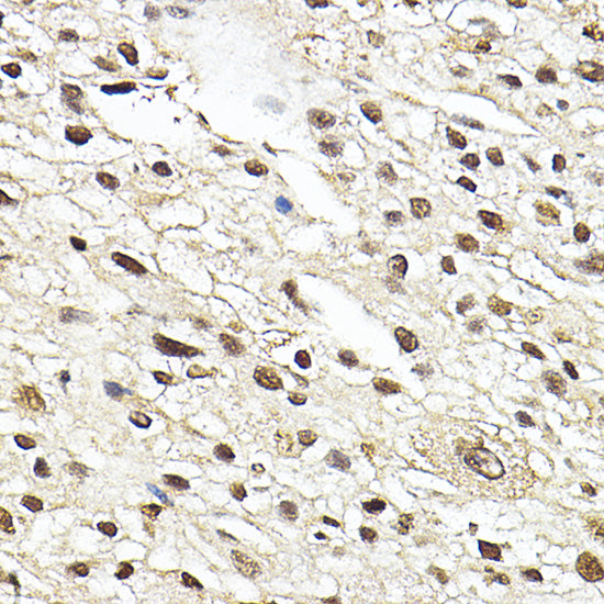 Glucocorticoid Receptor Rabbit pAb
