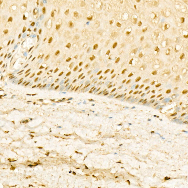 Glucocorticoid Receptor Rabbit pAb