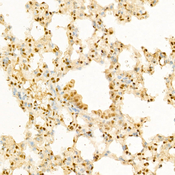 Glucocorticoid Receptor Rabbit pAb