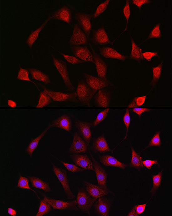 Glucocorticoid Receptor Rabbit pAb