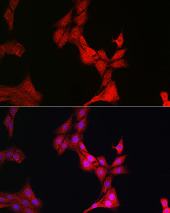 Glucocorticoid Receptor Rabbit pAb