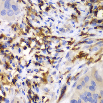 HCLS1 Rabbit pAb