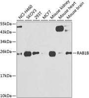 RAB1B Rabbit pAb
