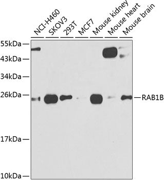 RAB1B Rabbit pAb