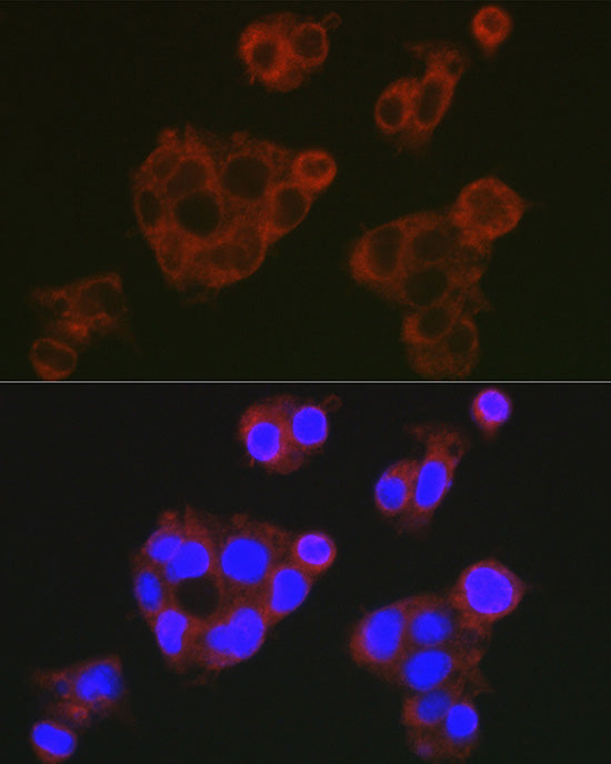 Complement factor H Rabbit pAb