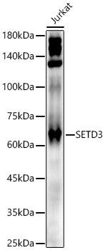 SETD3 Rabbit pAb