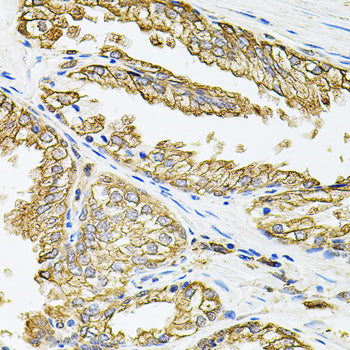 HLA-DQA1 Rabbit pAb